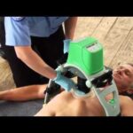 what does a chest compression feedback device monitor